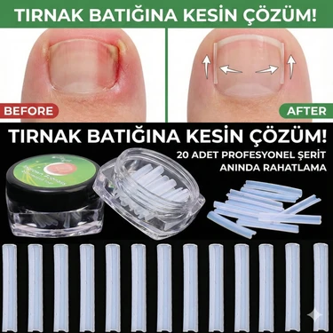 Lovyco Batık Tırnak Düzeltici Plastik Şeritler 20